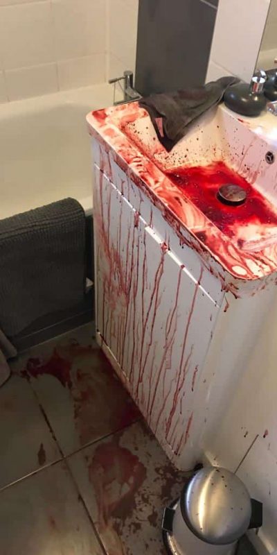 blood-cleanup